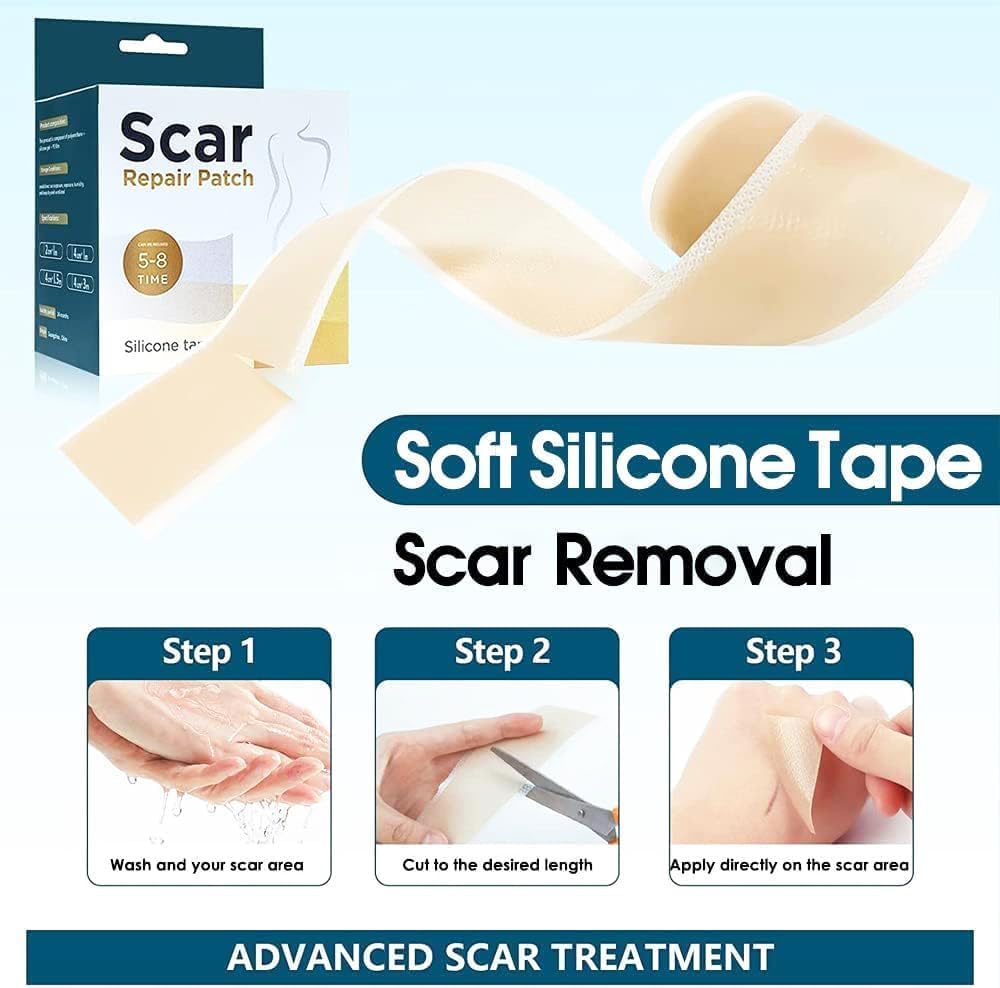 SKY-TOUCH Silicone Scar Sheets,Extra Long Scar Sheets for C-Section, Tummy Tuck, Keloid, and Surgical Scars - Reusable Medical Grade Silicone Scar Tape(4 x 150cm/2 Rolls) - 6